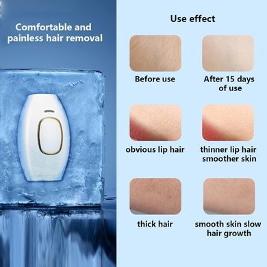 Портативный женский домашний фотоэпилятор для тела IPL Hair Removal Device для всех типов волос ∙ Женский лазерный эпилятор для всего тела IPL Hair Removal