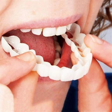 Съемные виниры для зубов Snap On Smile на 2 челюсти &bull; Накладные виниры на верхнюю и нижнюю челюсть для красивой улыбки