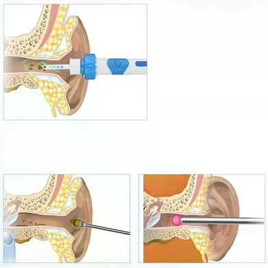 Ухочистка DEOcross C-ears TV One электрическая &bull; Компактный прибор DEOcross C-ears TV One с мягкими сменными насадками для ухода за ушами